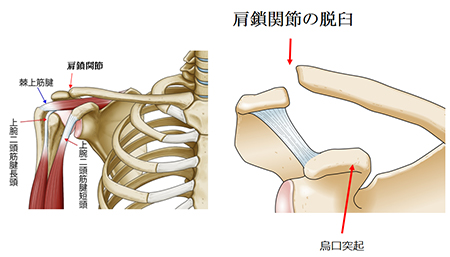 鎖 関節 肩